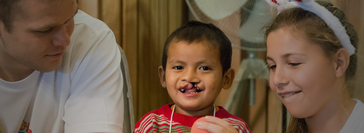 One of every 700 newborn babies is born with a cleft.