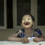 Girl waiting for surgery in Myanmar 2015